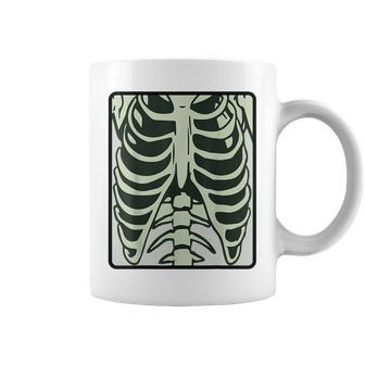 Skeleton Chest Xray Costume Horror Human Radiography Pink Horror Coffee Mug | Mazezy