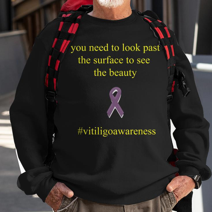 Vitiligo Look Past The Surface Motivational Quote Sweatshirt Gifts for Old Men