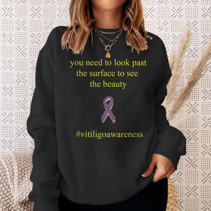 Vitiligo Look Past The Surface Motivational Quote Sweatshirt Gifts for Her