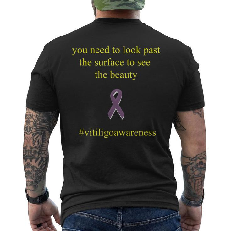 Vitiligo Look Past The Surface Motivational Quote Men's T-shirt Back Print