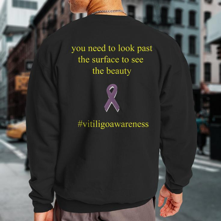 Vitiligo Look Past The Surface Motivational Quote Sweatshirt Back Print